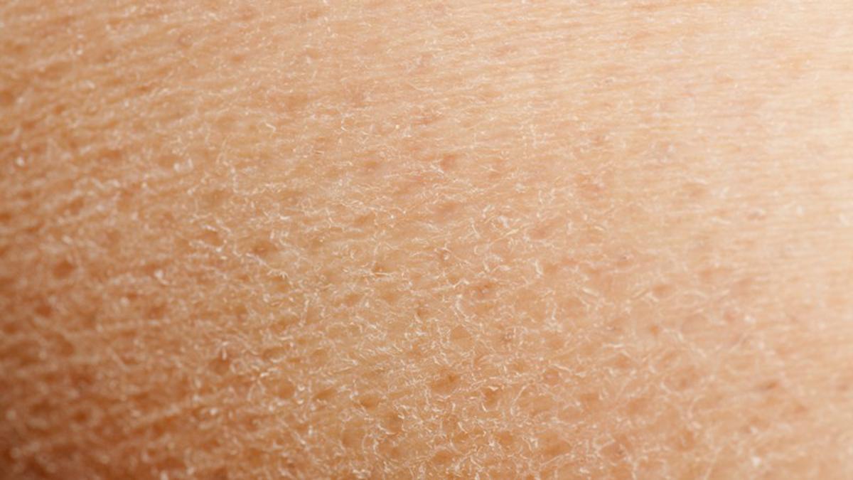 7 Bahan Alami Atasi Kulit Kering, Mudah Didapatkan di Dapur