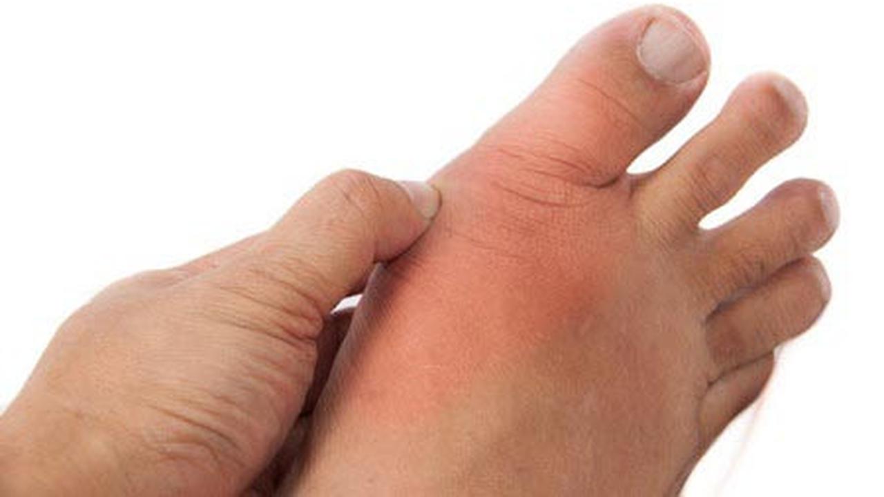 Ciri Ciri Kaki Bengkak karena Ginjal