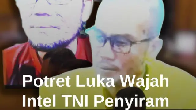 Potret Luka di Wajah Intel TNI Pelaku Penyiram Air Keras ke Aktivis Andrie Yunus