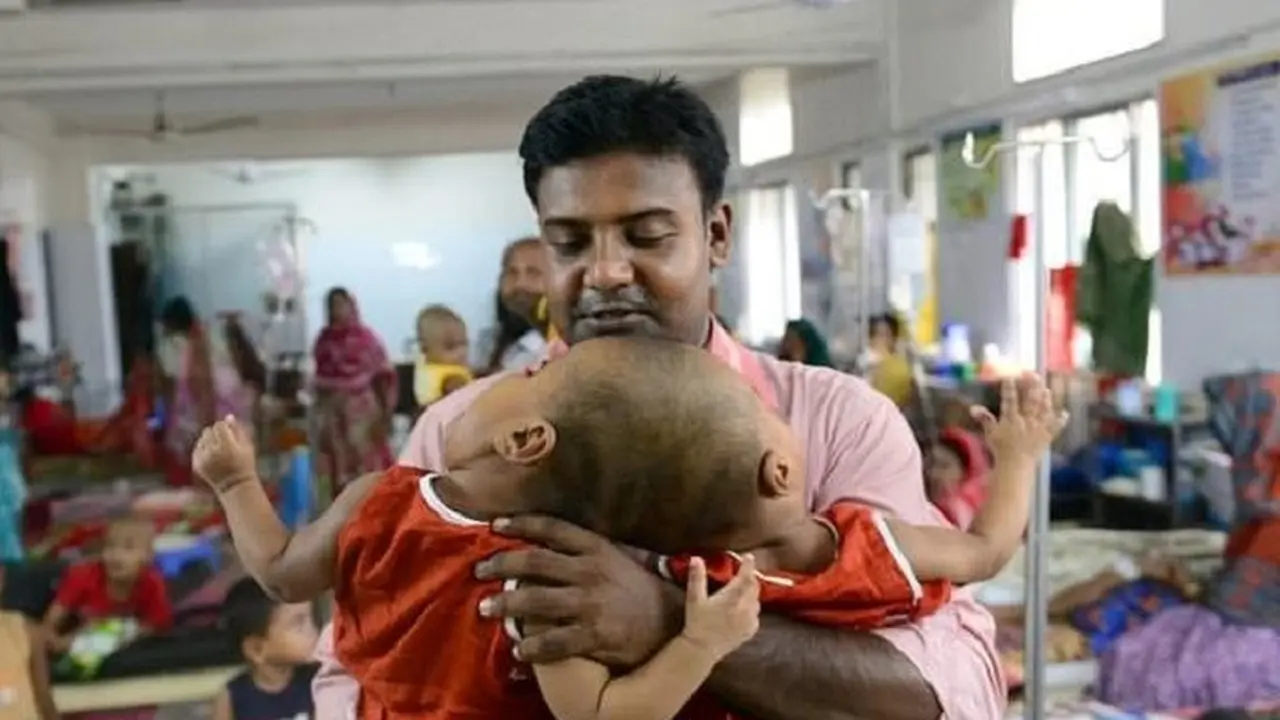 Rabia dan Rukia, bayi kembar siam asal Bangladesh ini masih berusia satu tahun (AFP)