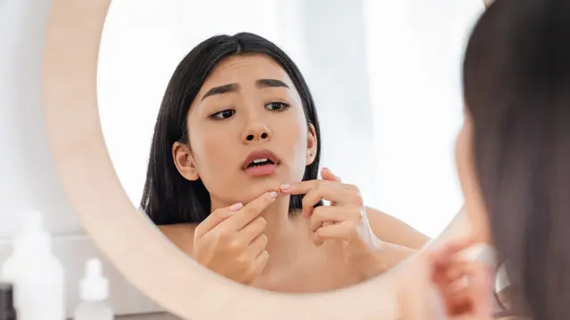 Jerawat pada Ibu Hamil, Awas Penanganan Kurang Tepat! Intip Penyebab dan Cara Aman Mengatasinya