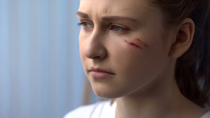 Cara Menghilangkan Bekas Luka di Wajah