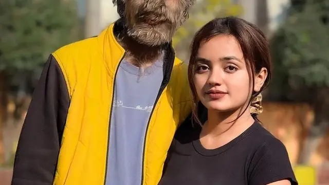 Pria Ini Dijuluki sebagai Manusia Serigala Usai Alami Kelainan, Kisahnya Viral