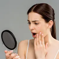 ilustrasi jerawat/LightField Studios/shutterstock