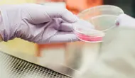 Terapi Stem Cell Berkembang di Indonesia, Mutu dan Keamanan Jadi Perhatian