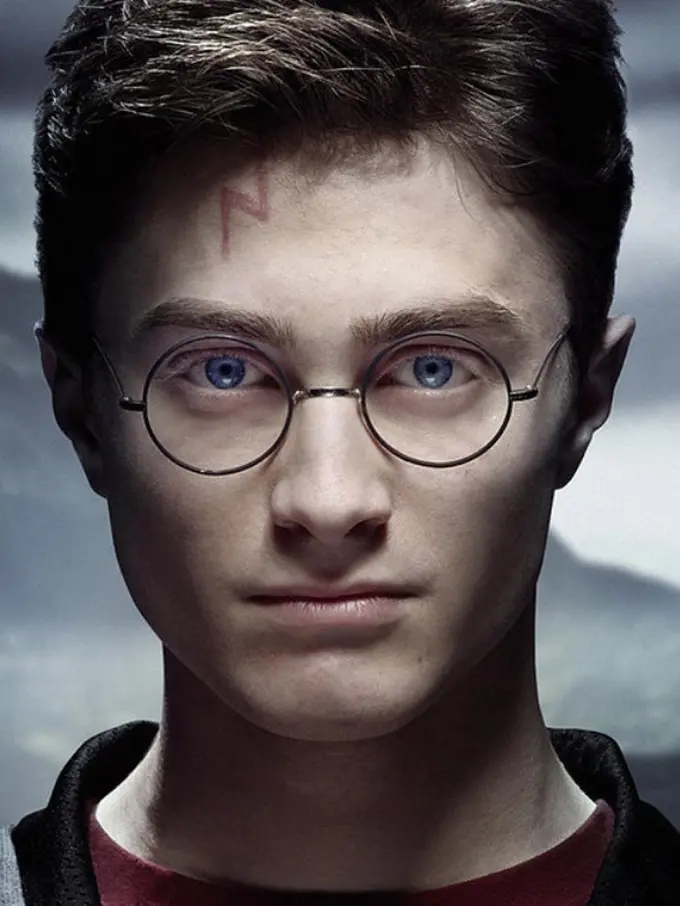 Berawal dari Luka, Anak Ini Berubah Jadi Harry Potter!