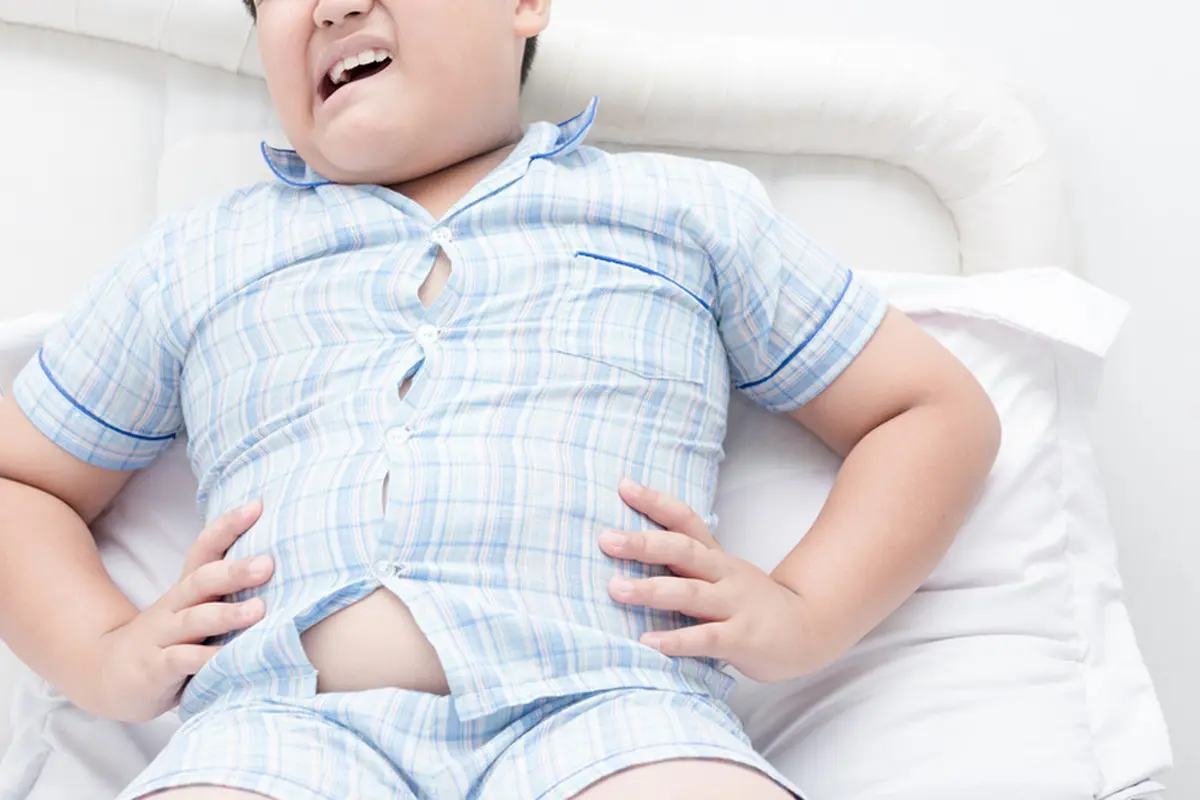 Anak obesitas