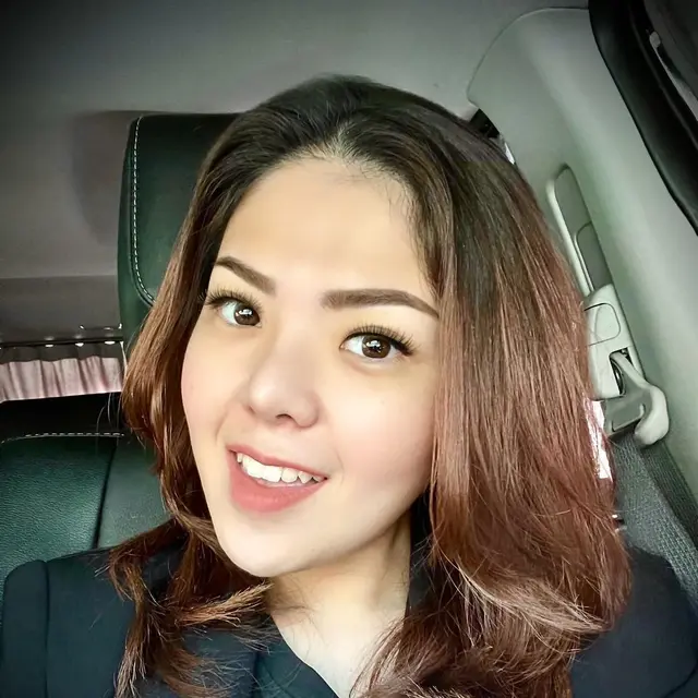 6 Mantan Artis Cilik Ini Pernah Dituding Oplas, Akui Hanya Perawatan Wajah
