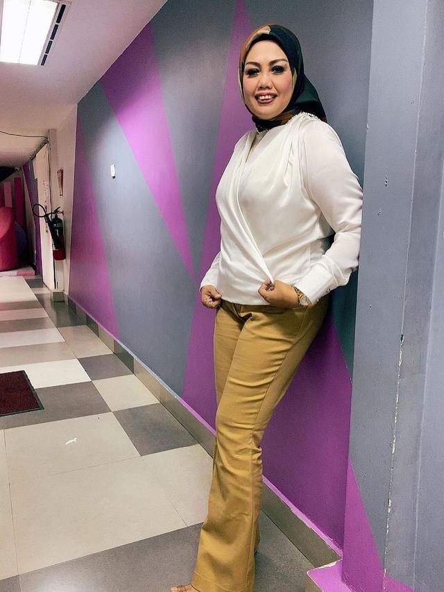 Elly Sugigi Unggah Foto Tanpa Hijab, Dulu Tutup Aurat karena Mimpi