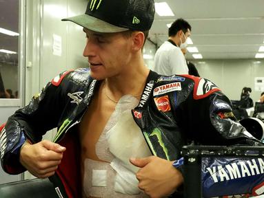 Pembalap Yamaha, Fabio Quartararo memamerkan tubuhnya yang penuh dengan tempelan perban akibat insiden Quartararo yang menabrak motor Marc Marquez pada awal-awal balapan MotoGP Aragon, pekan lalu. (AFP/Toshifumi Kitamura)