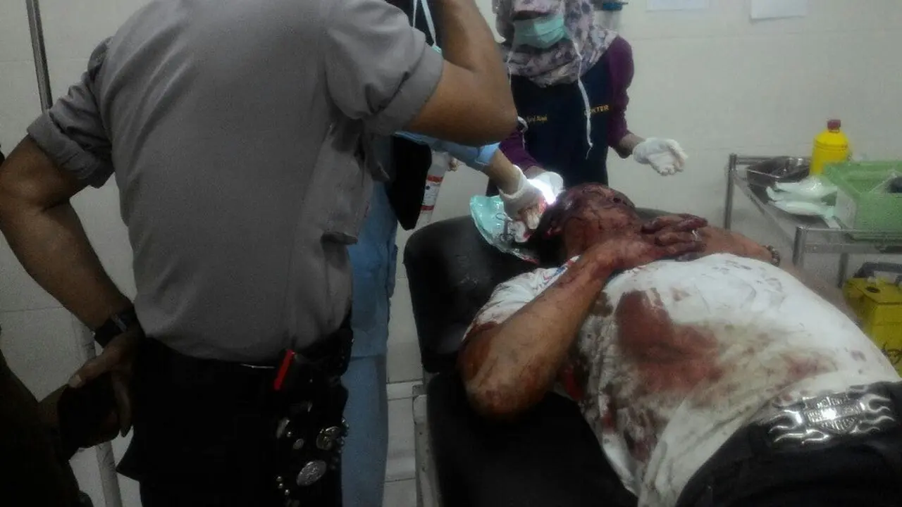 Pemalak mengalami luka robek akibat hantaman batu marmer (Liputan6.com/ Eka Hakim)