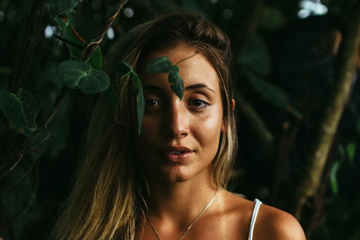 [Fimela] Sunburn