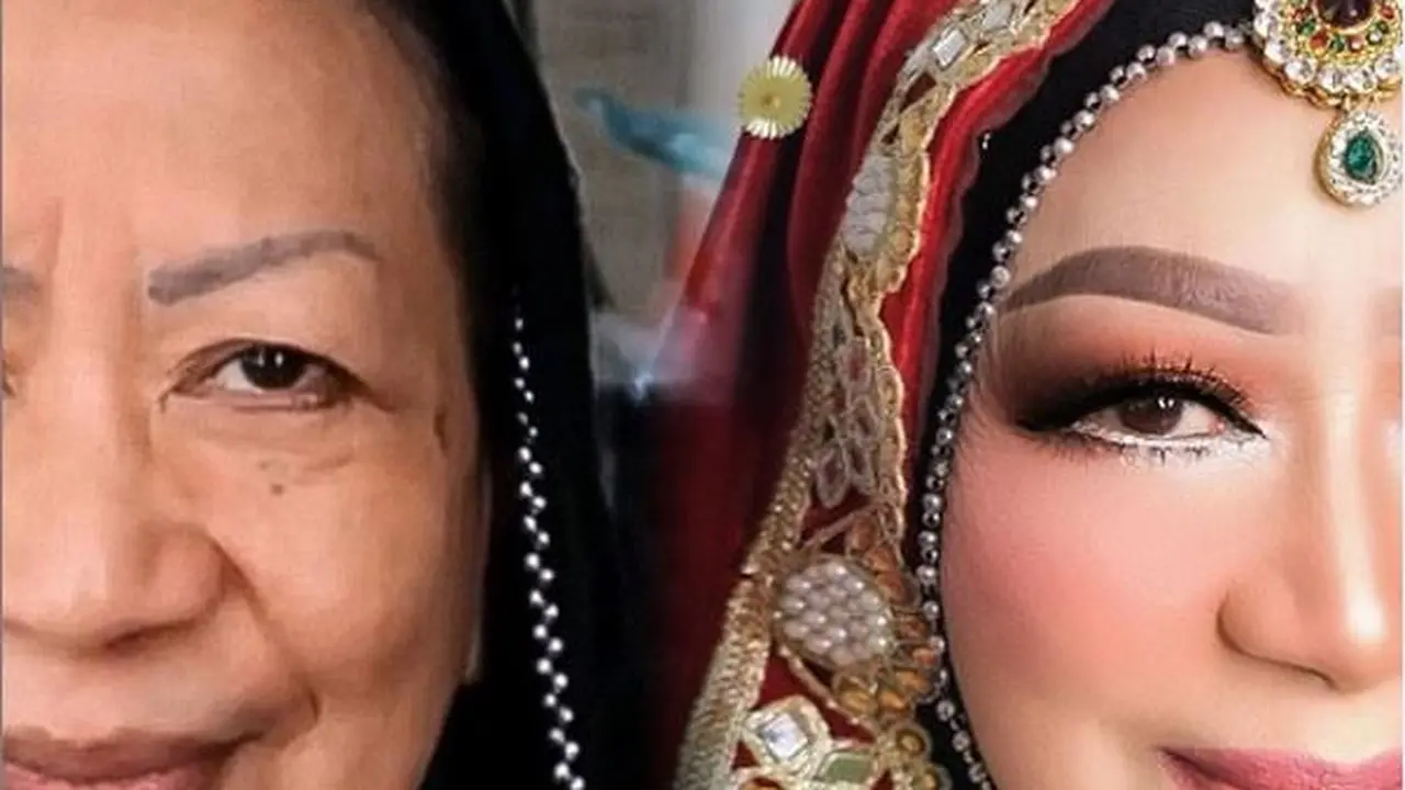 Trik Ubah Mata Kendur Nenek 72 Tahun Jadi Kencang Tanpa Operasi