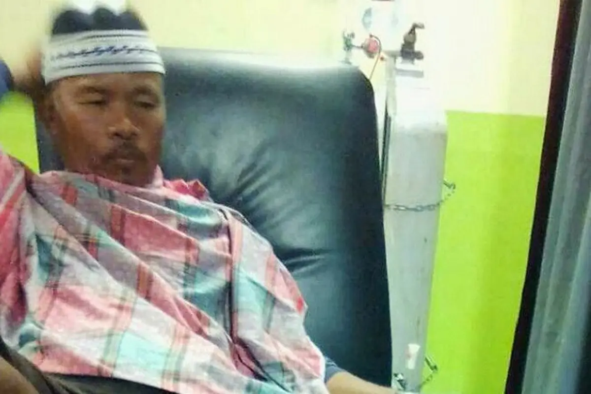 Kisah Selamat dari Siak yang Selamat Setelah Diterkam Buaya Ganas