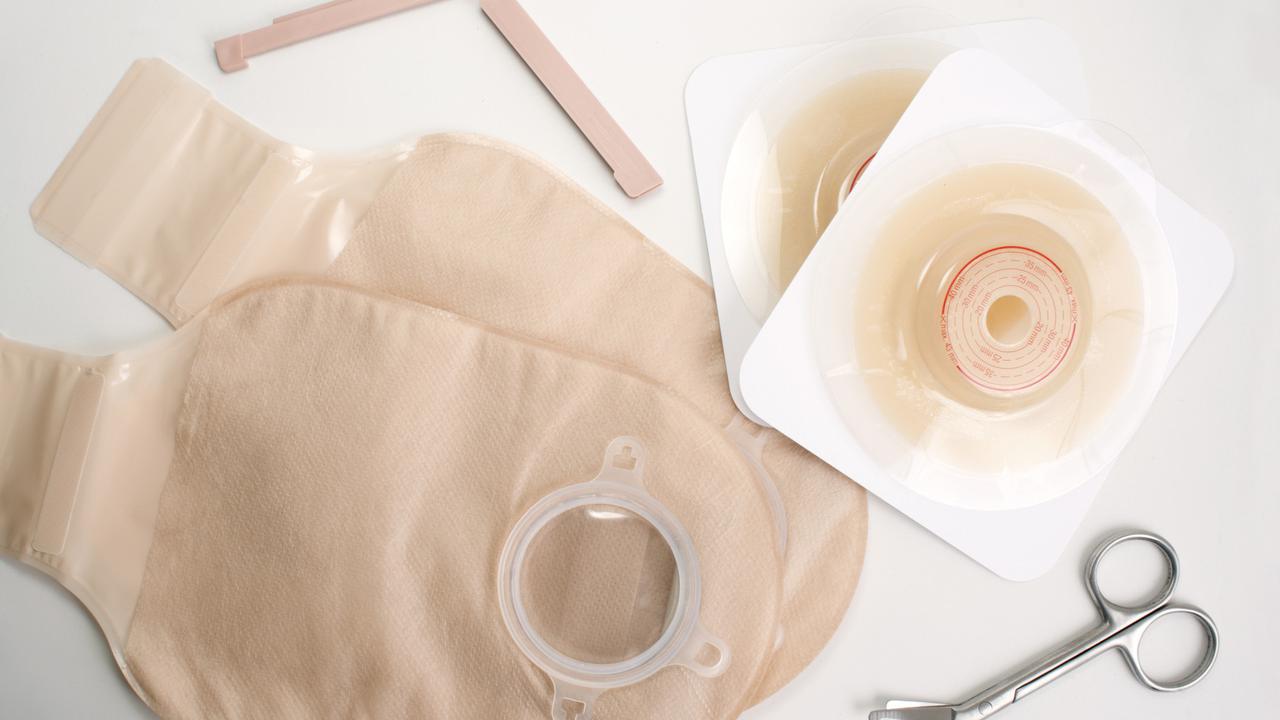 Kantong stoma atau kantong kolostomi (Foto: Ilustrasi/ Huffington Post)