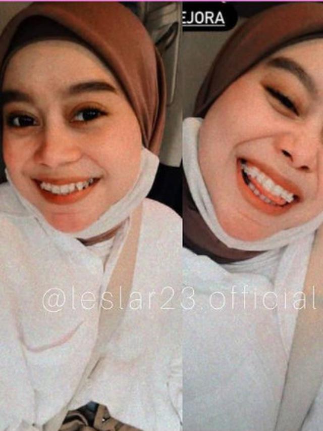 Lesti Kejora Pakai Behel - Pakai Busana Serba Kuning ...