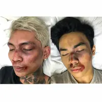 Makeup lebam ala Young Lex. (Foto: instagram.com/mukamemarlexchallenge)