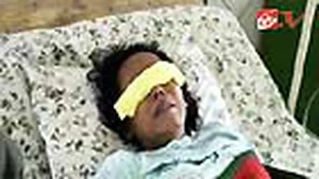 Cemburu buta membuat seorang lelaki di Brebes, Jawa Tengah, kalap. Bahkan, ia nyaris mencungkil mata istrinya. 