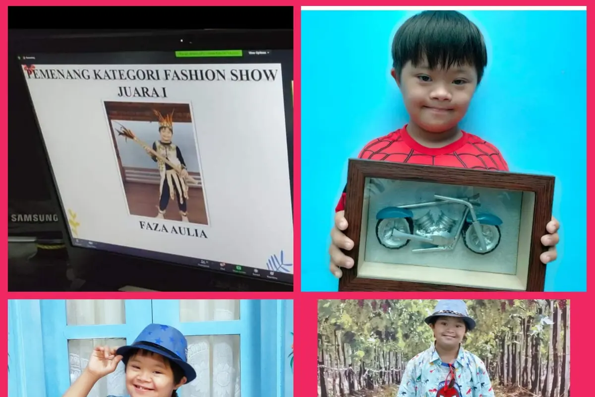 Bocah Down Syndrome Asal Malang M. Faza Aulia Rahadiyanto.