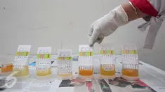Sampel urine pegawai Kementerian Pembangunan Manusia dan Kebudayaan (PMK), Jakarta, Senin (14/3). Bekerjasama dengan BNN, 220 pegawai di lingkungan kementerian PMK melakukan tes urine untuk mencegah penyalahgunaan narkoba. (Liputan6.com/Angga Yuniar)