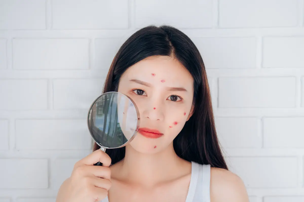 skincare-kezo