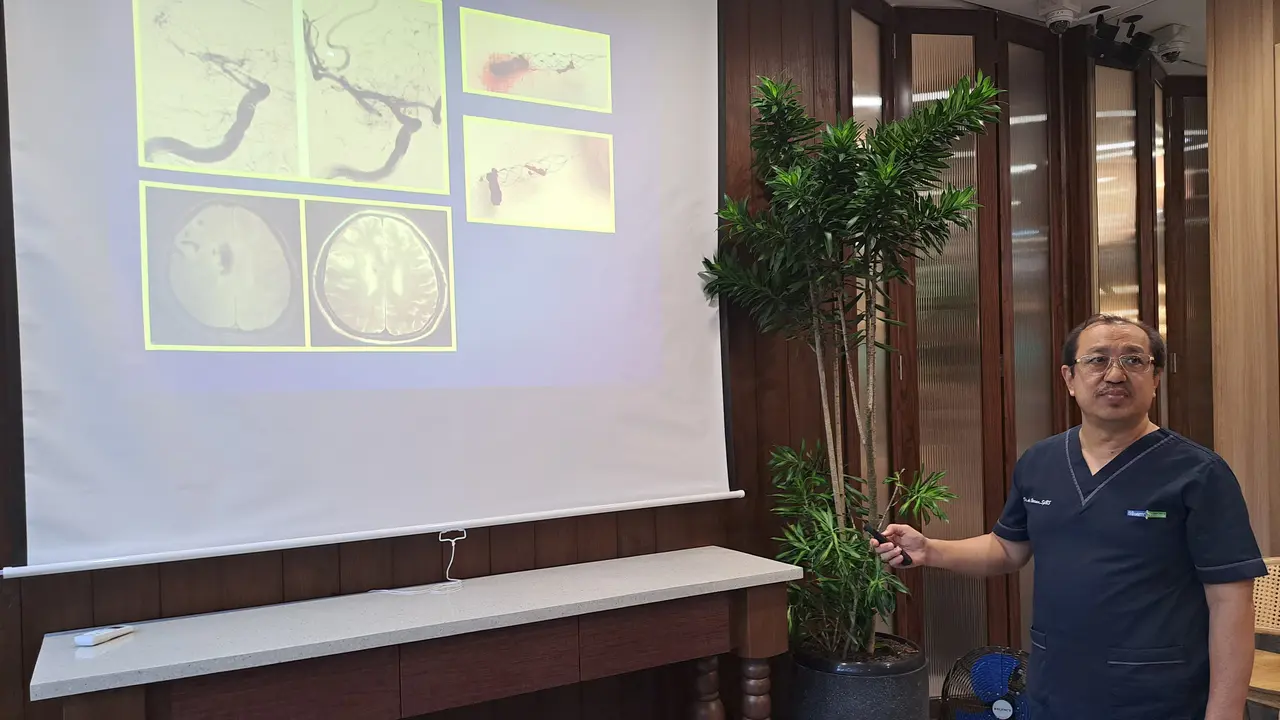 Waspada Gejala Stroke, Jika Alami Sakit Kepala Berat Mendadak Segera Cek ke Dokter