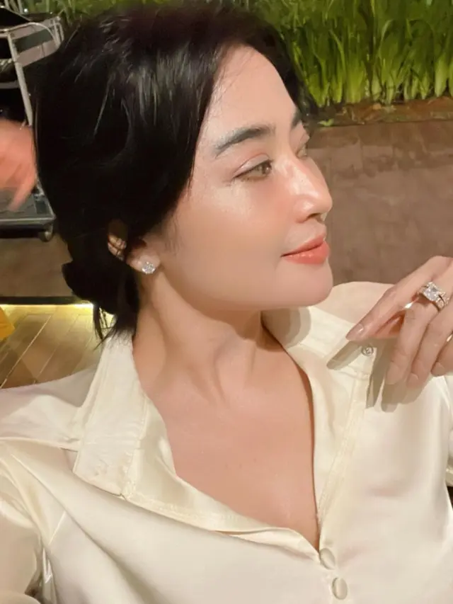 Artis Wajah Bengkak Pasca Oplas