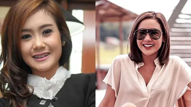 6 Transformasi Seleb Setelah Perbaikan Gigi, Terbaru Elly Sugigi
