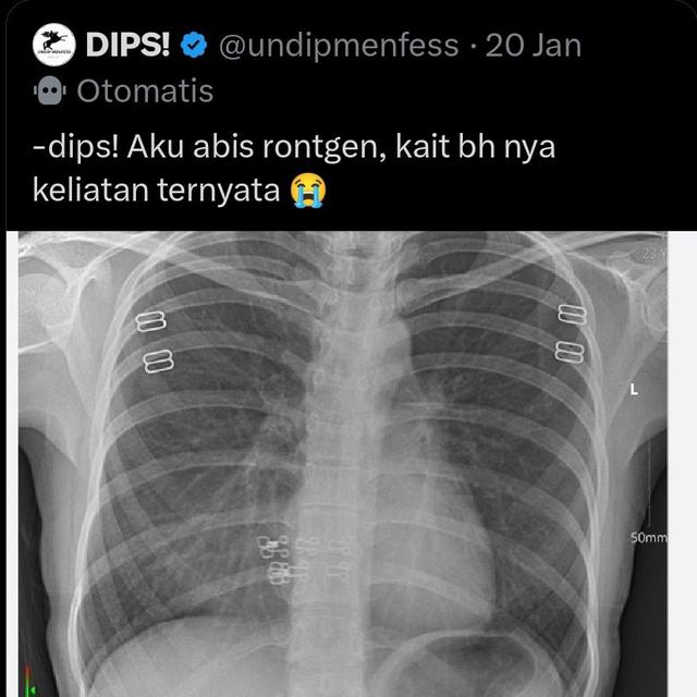 6 Cuitan Random Netizen di Menfess Kampus Undip Ini Bikin Tepuk Jidat