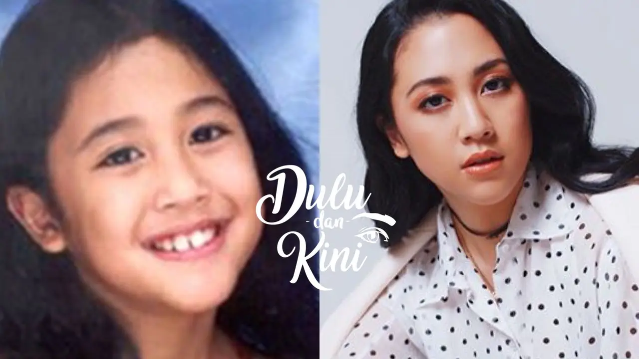 Dulu dan Kini: Transformasi Sherina Munaf Bikin Pangling, Jadi Super Cantik