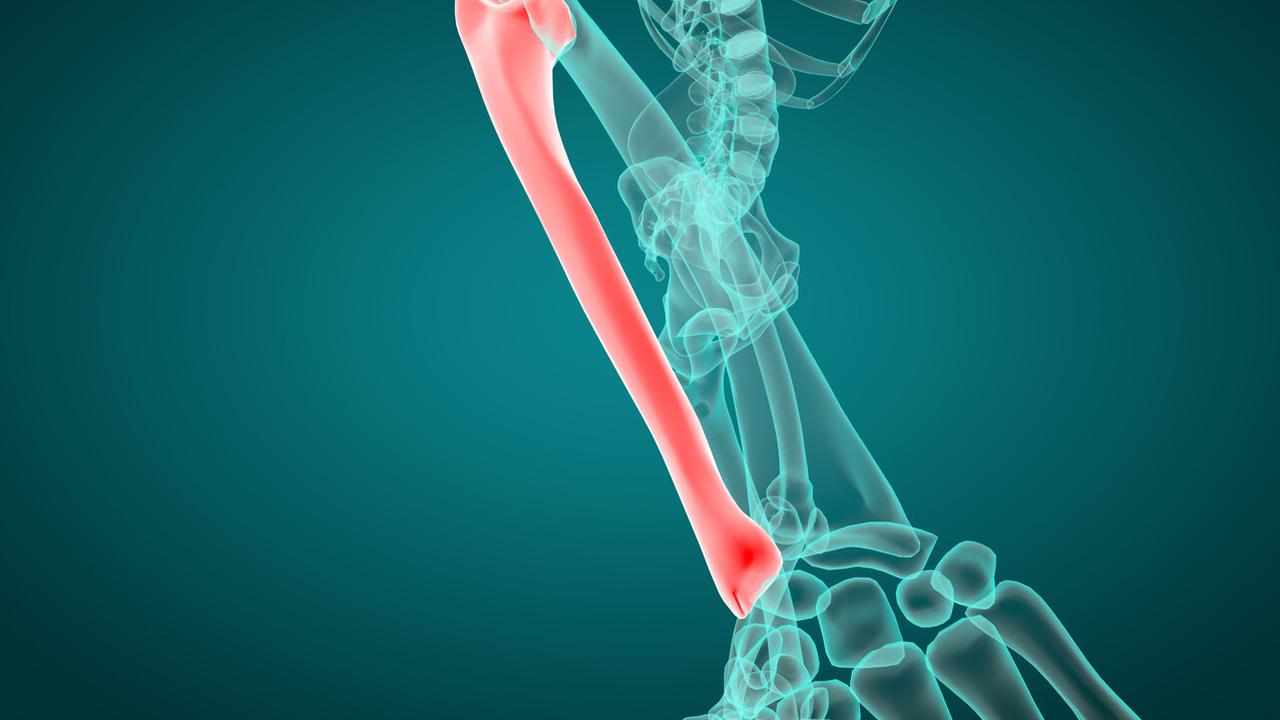 Gangguan tulang hasta