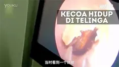 Dokter harus menyemprot bahan kimia untuk mengeluarkan kecoa itu.