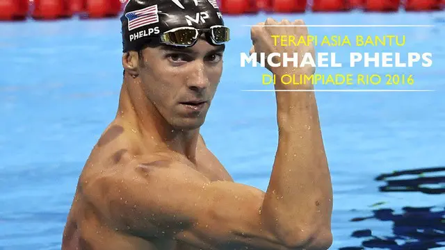 Terapi dari Asia, Kop, menjadi sorotan di Olimpiade Rio 2016. Perenang asal Amerika Serikat, Michael Phelps, juga melakukan terapi kop.