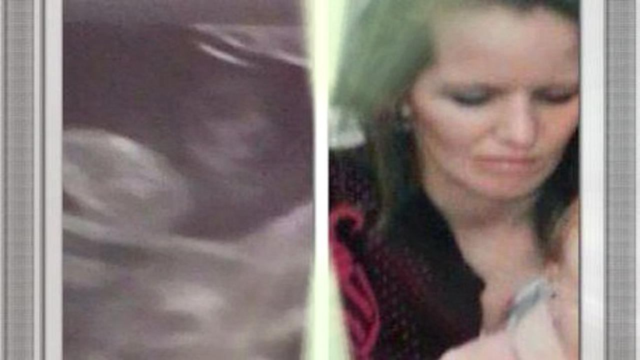 Wanita Hamil Lihat Wajah Mendiang Ibu di Foto USG