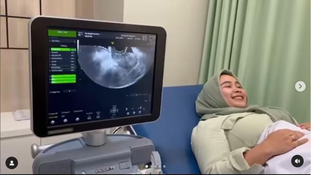 Setahun Melahirkan, Ini 6 Potret Syifa Adik Ayu Ting Ting Hamil Anak Kedua