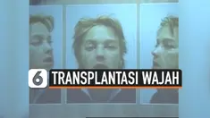 THUMBNAIL TRANSPLANTASI