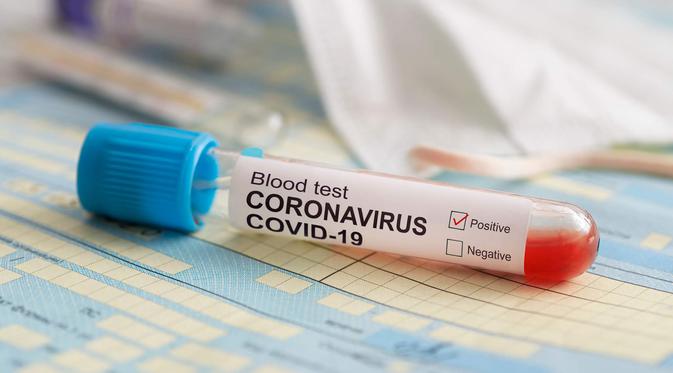 ilustrasi virus corona/copyright by diy13 (Shutterstock)