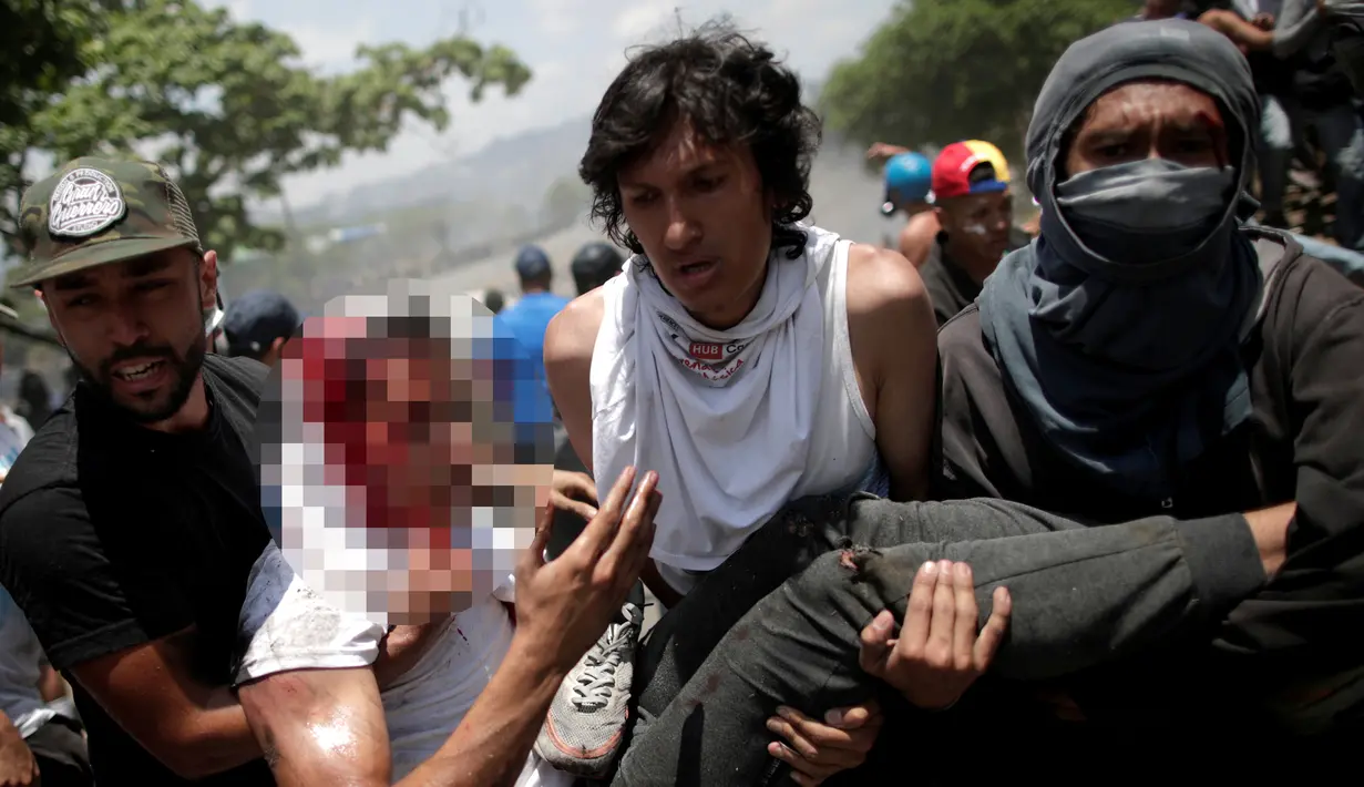 Pengunjuk rasa pendukung oposisi, Luis Alejandro saat dievakuasi rekannya setelah ditabrak kendaraan taktis Garda Nasional Venezuela di luar pangkalan militer 'La Carlota' di Caracas, Venezuela (30/4/2019). (Reuters/Ueslei Marcelino)