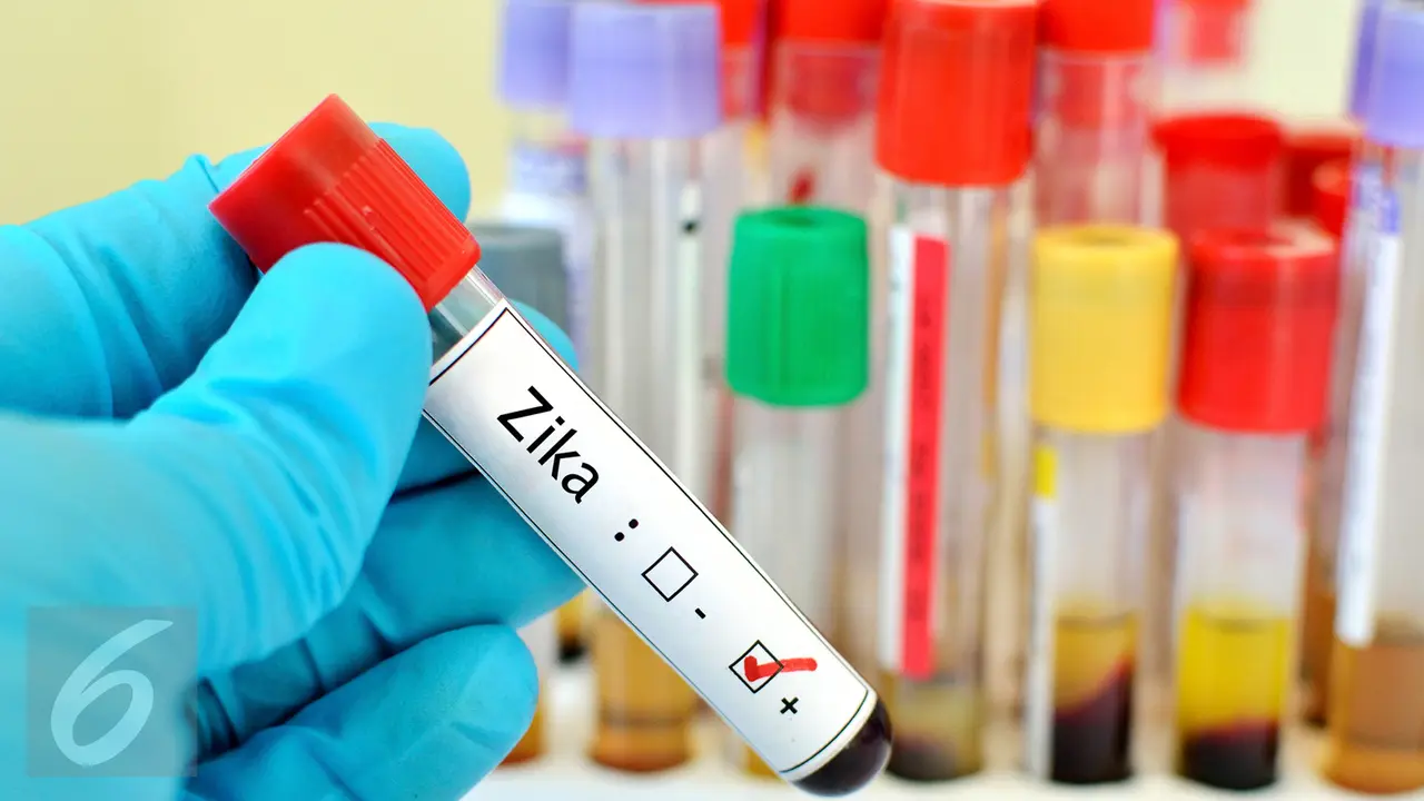 Virus Zika