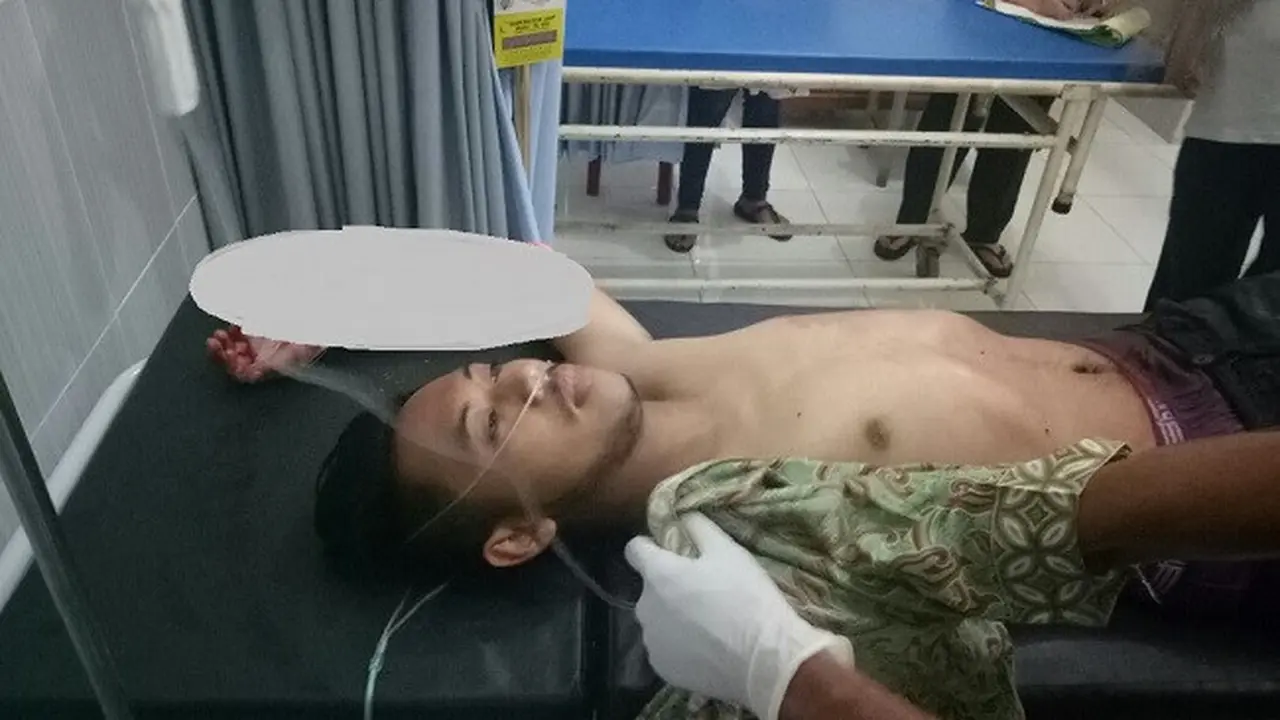 Luka Fatal Akibat Iseng Bunyikan Knalpot Brong
