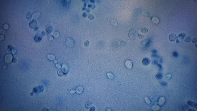 Ilustrasi virus Candida Auris