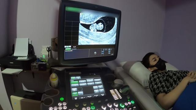 Bayinya Sehat, Ini 6 Momen Chelsea Olivia Periksa Kandungan