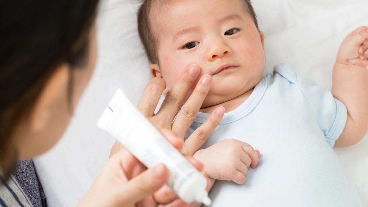 Anti Ruam &amp; Kering, Intip Rekomendasi Skincare Anak yang Harus Moms Punya
