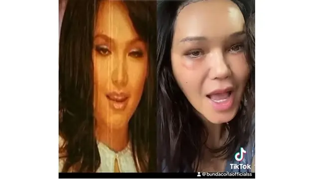 6 Potret Bunda Corla Dibilang Mirip Siti Nurhaliza, Pasca Oplas Rp1,5 Miliar