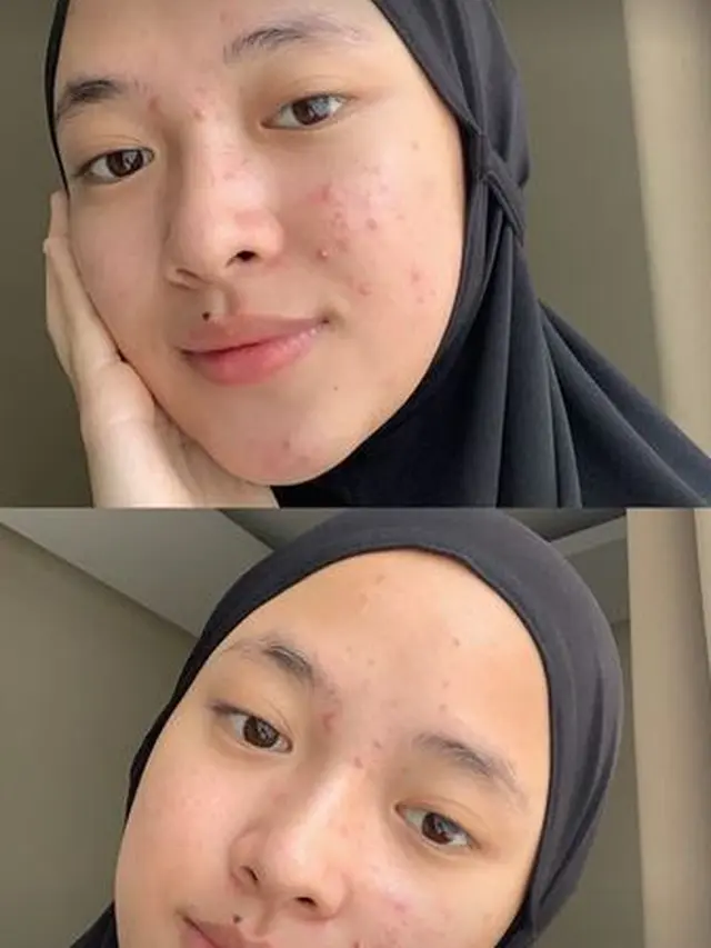 Unggah Foto Berjerawat, Ini 6 Potret Nissa Sabyan Tanpa Makeup