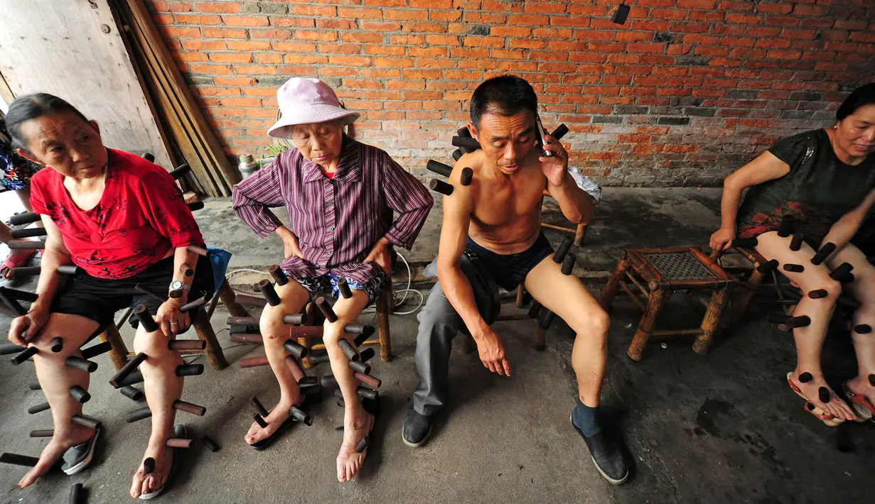 Sejumlah pasien menjalani terapi bekam tradisional di sebuah klinik di Pujiang County, Chengdu, Tiongkok (10/8). Terapi bekam telah menjadi salah satu pengobatan warisan leluhur bangsa Tiongkok. (REUTERS)