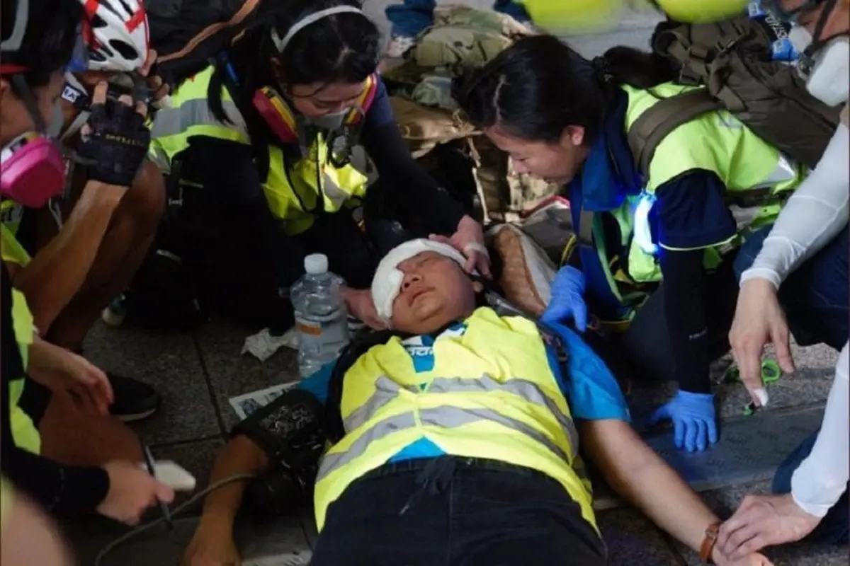 Jurnalis asal Indonesia Veby Mega Indah tertembak peluru karet saat meliput unjuk rasa di Hong Kong pada Minggu 29 September. (Twitter/@yukisuet1)