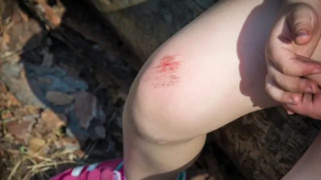 Nggak Banyak Diketahui, Inilah 4 khasiat Kantong Teh yang Bagus untuk Tubuh