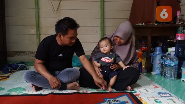 Balita Operasi Bibir Sumbing