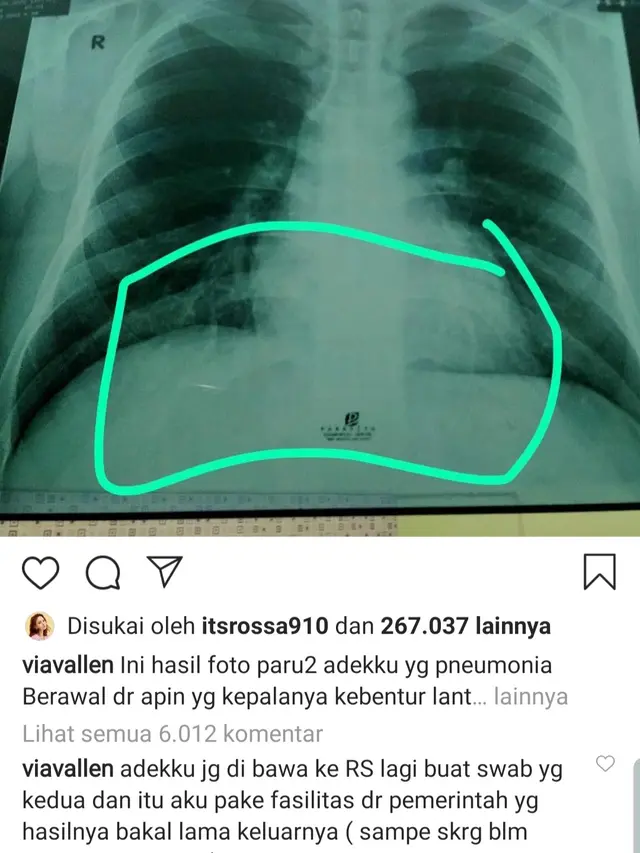 Unggahan Via Vallen. (Foto: Instagram @viavallen)